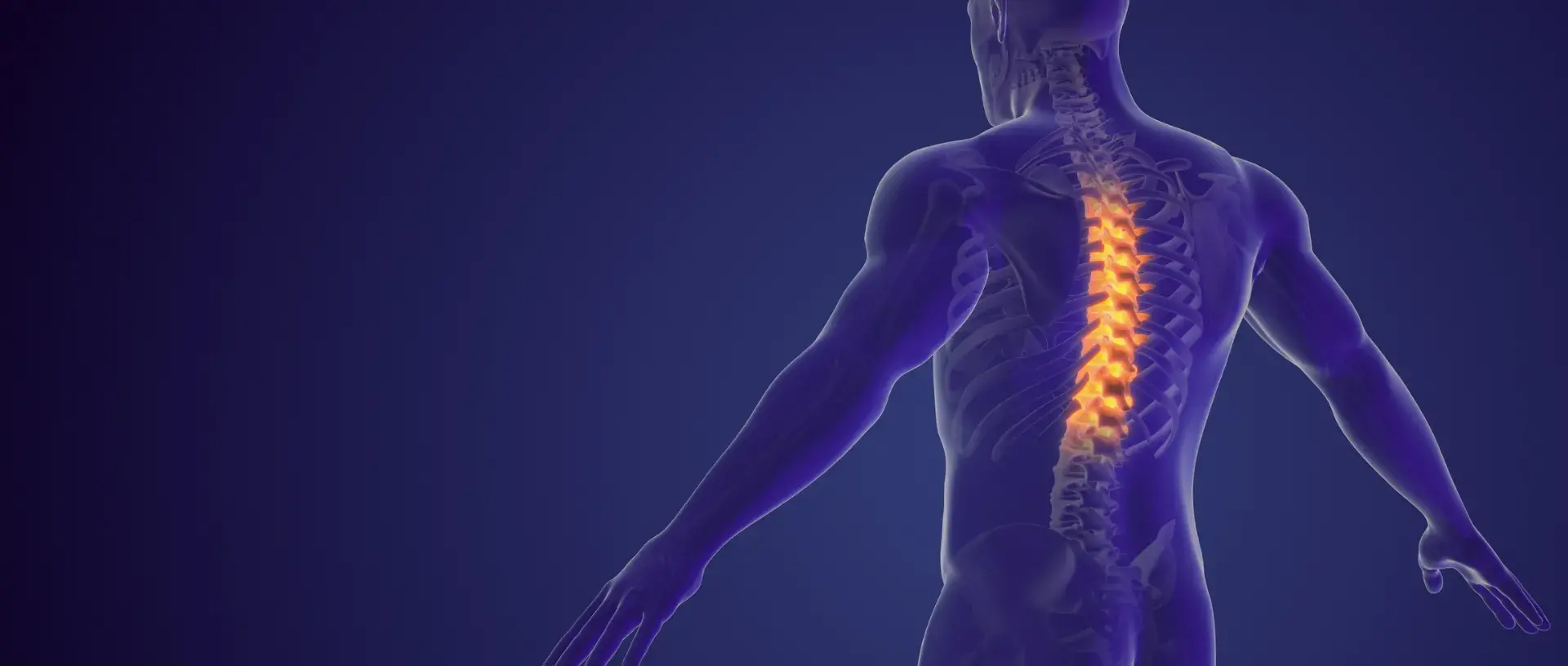 Rolfing® Structural Integration and Chronic Pain
