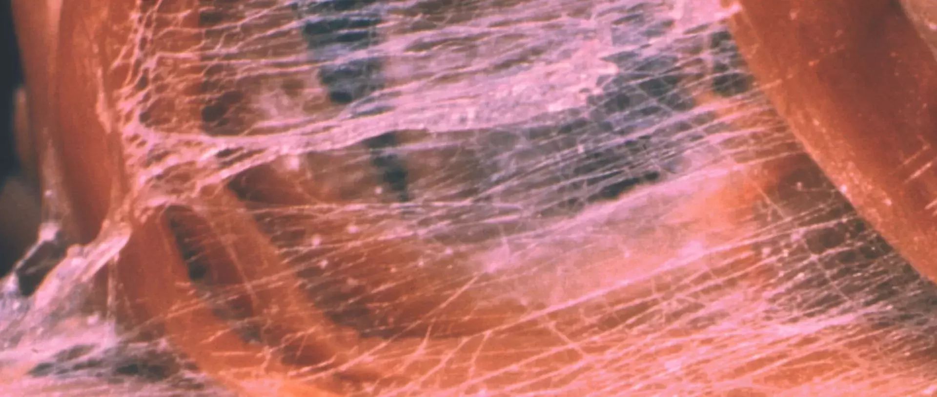 Myofasziale schmelzende Manipulation kann entzündungshemmende Wirkung haben