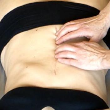 Rolfing® und Narben Rolfing® und Narben