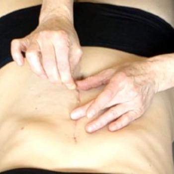Rolfing® und Narben Rolfing® und Narben