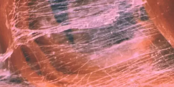 Myofascial melting manipulation can exert anti-inflammatory effects